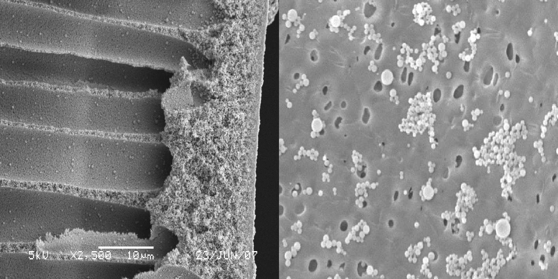 SEM image of organic membrane showing microplastic contamination